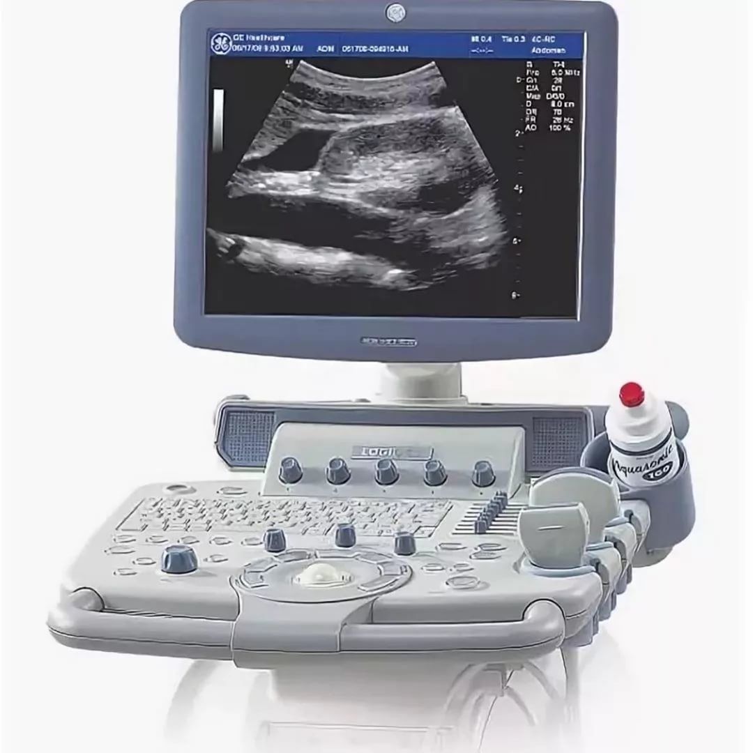 Аппараты УЗИ Аппараты УЗИ