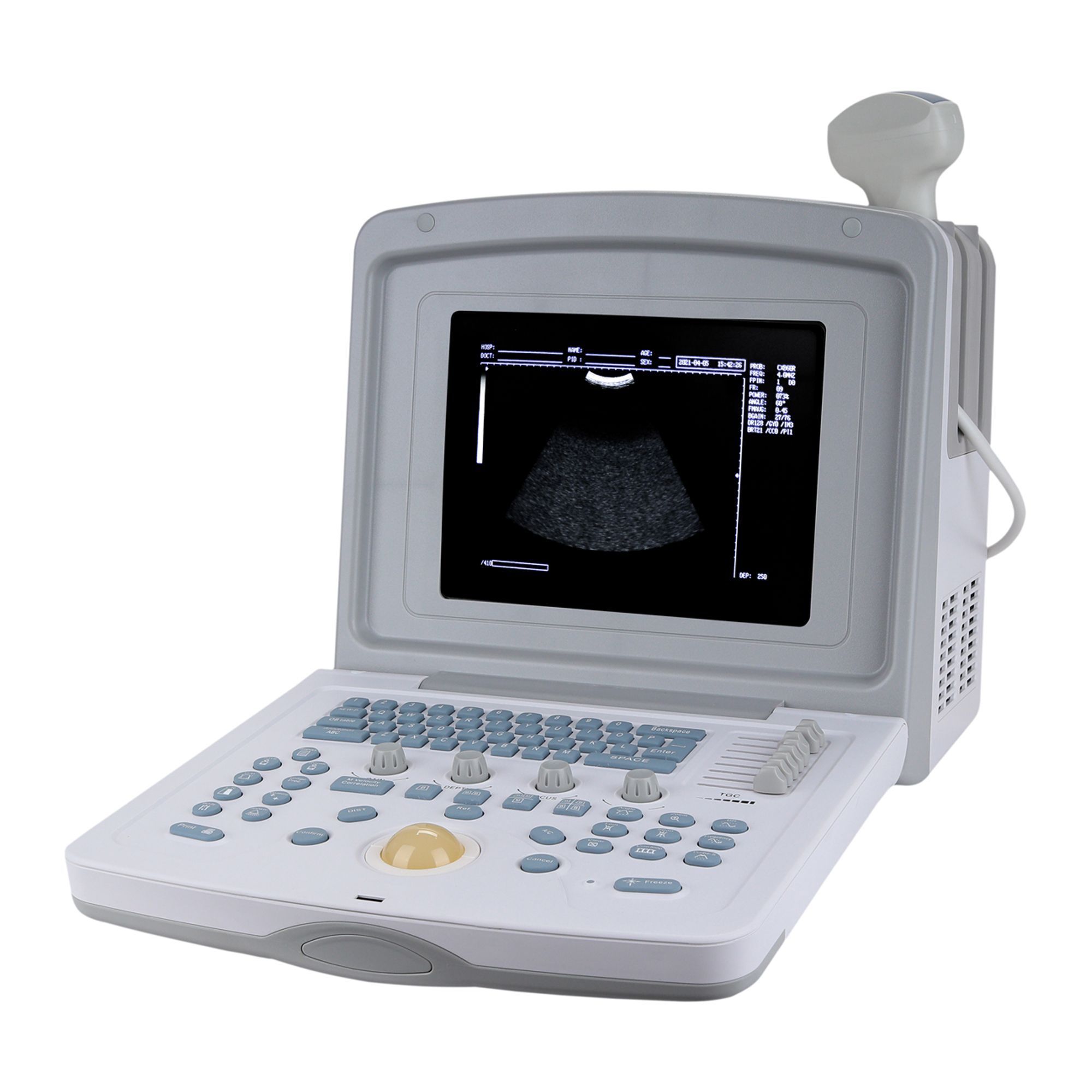 УЗИ сканер Med-Mos CMS600B3 фото